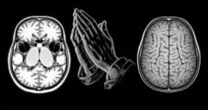 Before and after MRI scans showing brain healing miracle from severe damage